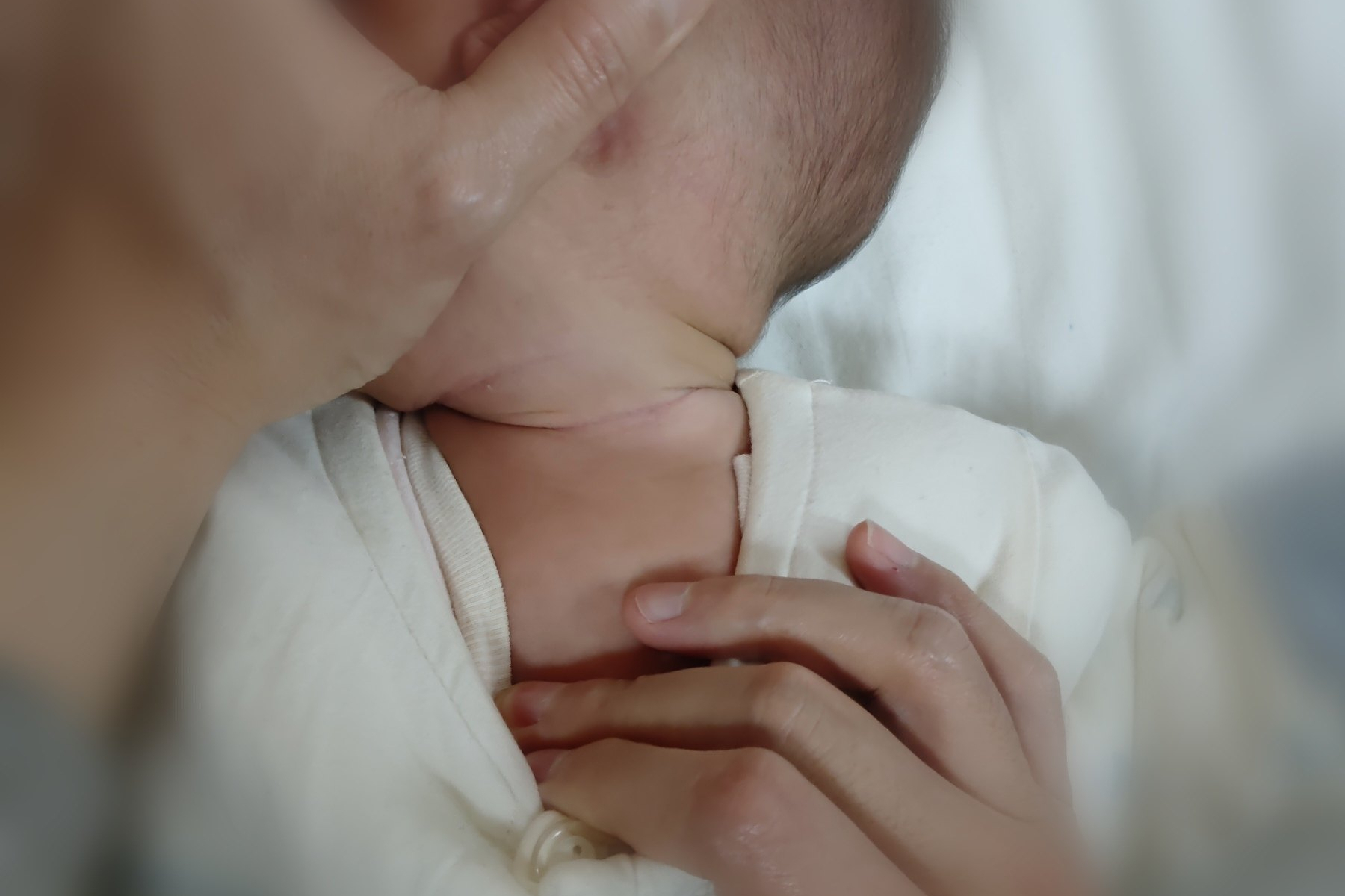 儿童骨科门诊常用的孩子斜颈筛查法