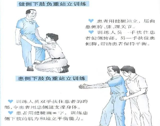 一篇文章了解脑卒中偏瘫患者上下肢的康复训练(图文并茂)