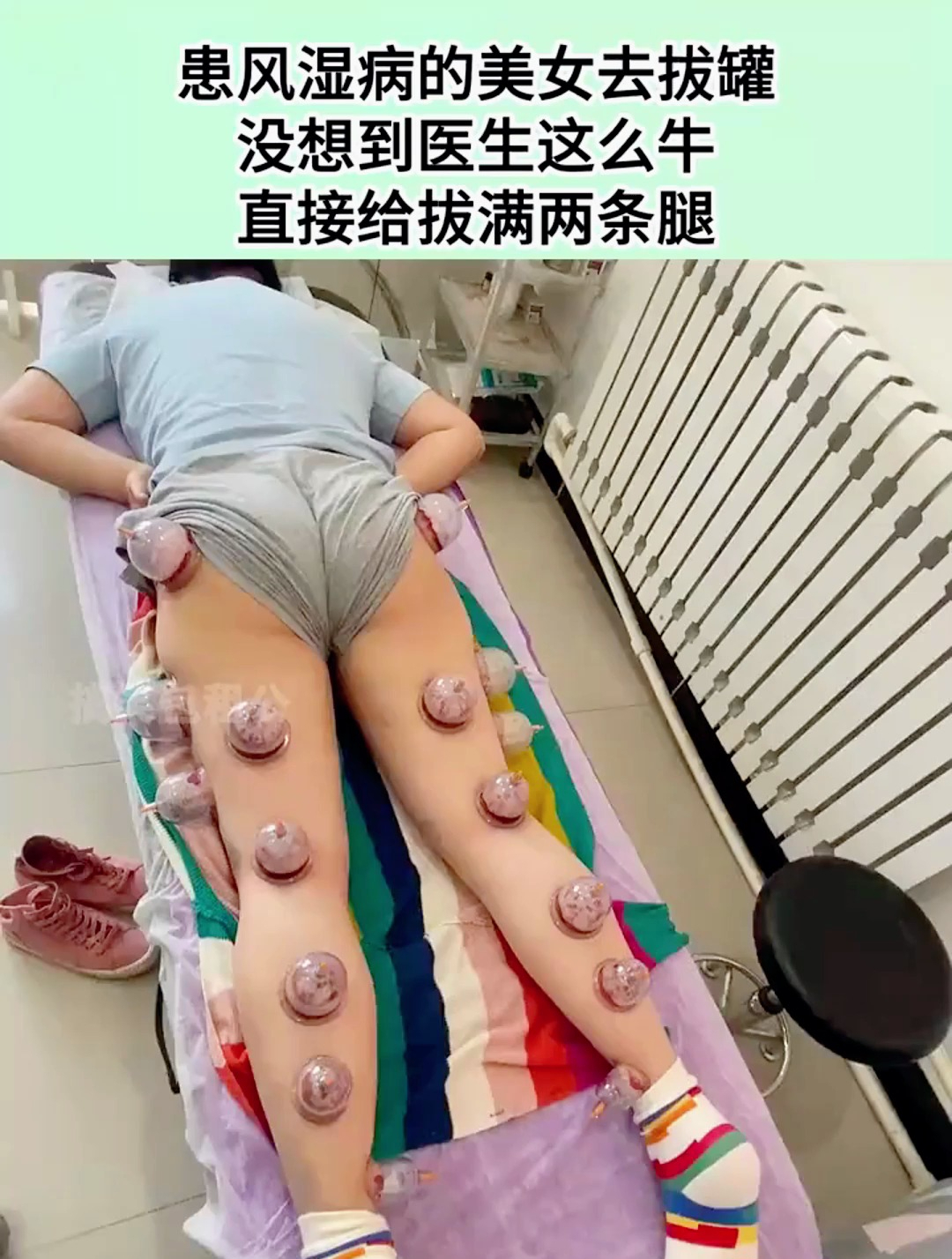 患风湿病的美女去拔罐,没想到医生这么牛,直接给拔满两条腿!-度小视