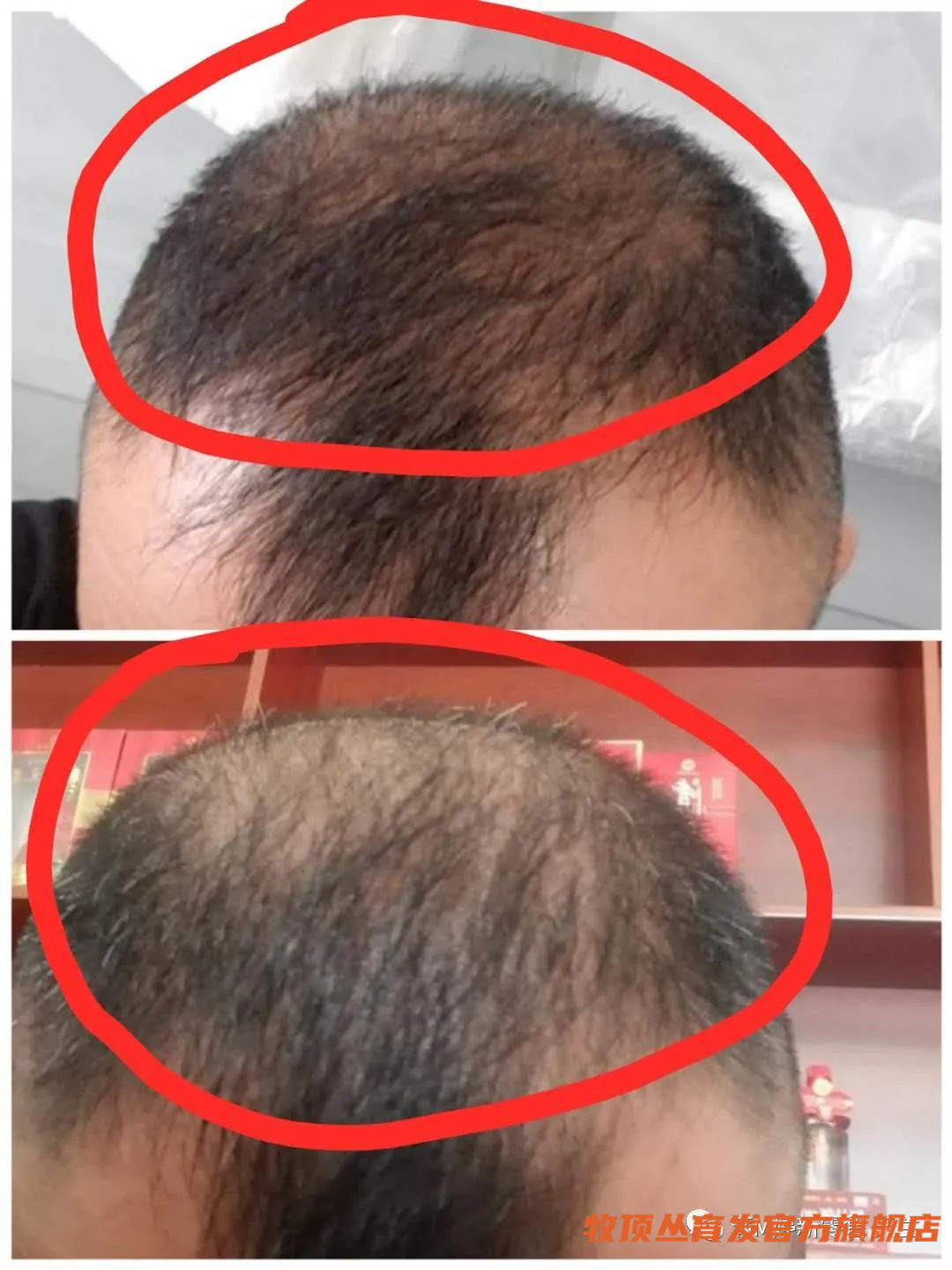 九鑫集团满婷牧顶丛育发——直击脱发焕然新生 解决脱发烦恼