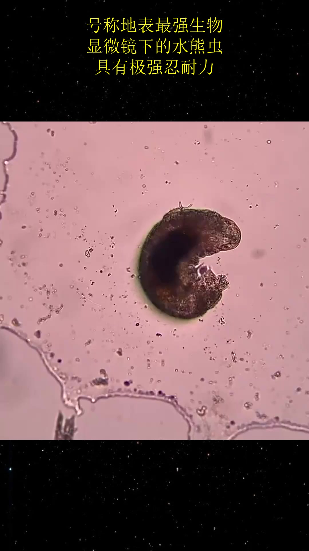 号称地表最强生物显微镜下的水熊虫具有极强忍耐力
