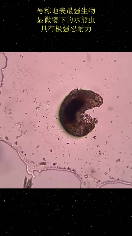 号称地表最强生物显微镜下的水熊虫具有极强忍耐力