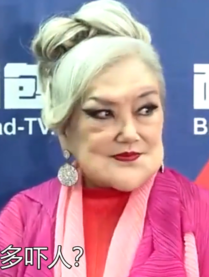 明星医美后遗症有多可怕?邵音音脸变形,水果姐眼睛不受控制 -11