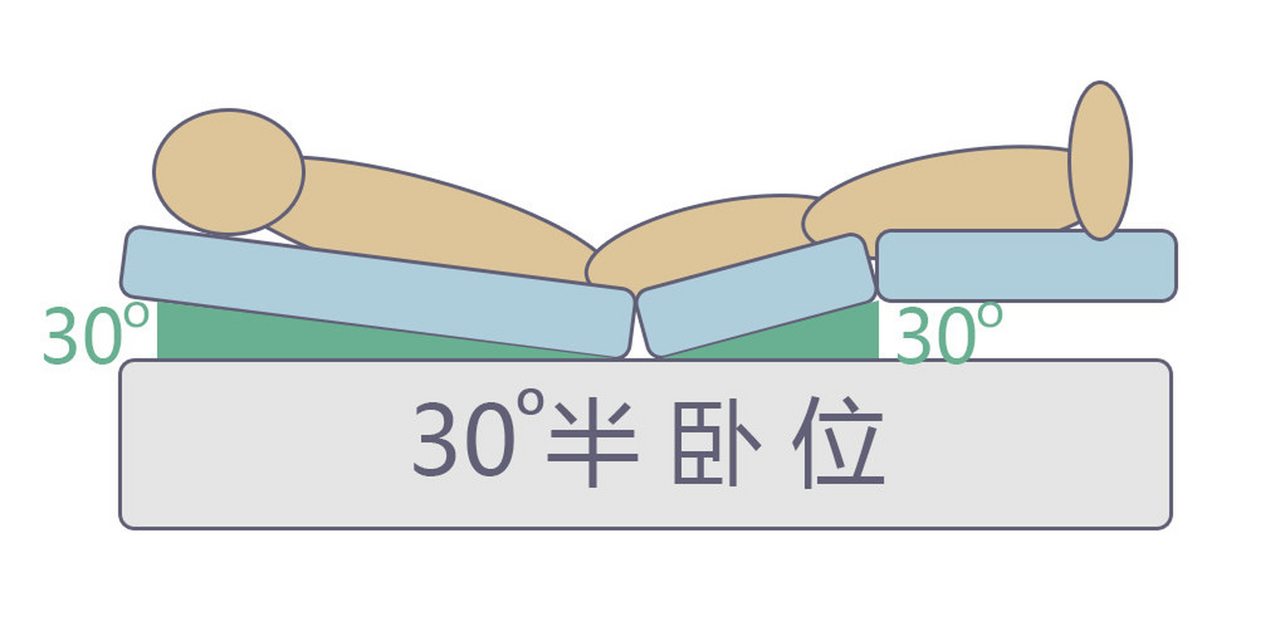 压疮# #褥疮# 什么是30°半卧位,图片演示