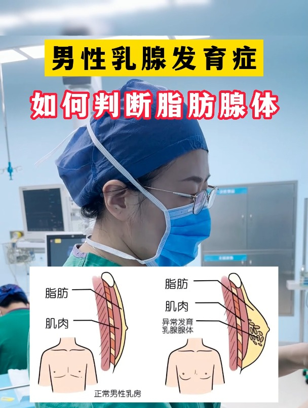 男性乳腺腺体发育图片