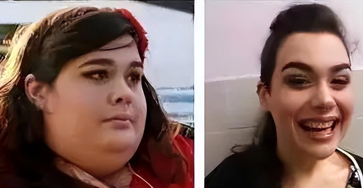 23岁女孩重600斤长出"象腿",长相似明星,减肥后却被男友抛弃