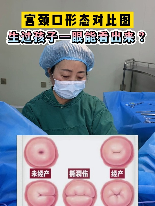 生过孩子一眼就能看出来吗?