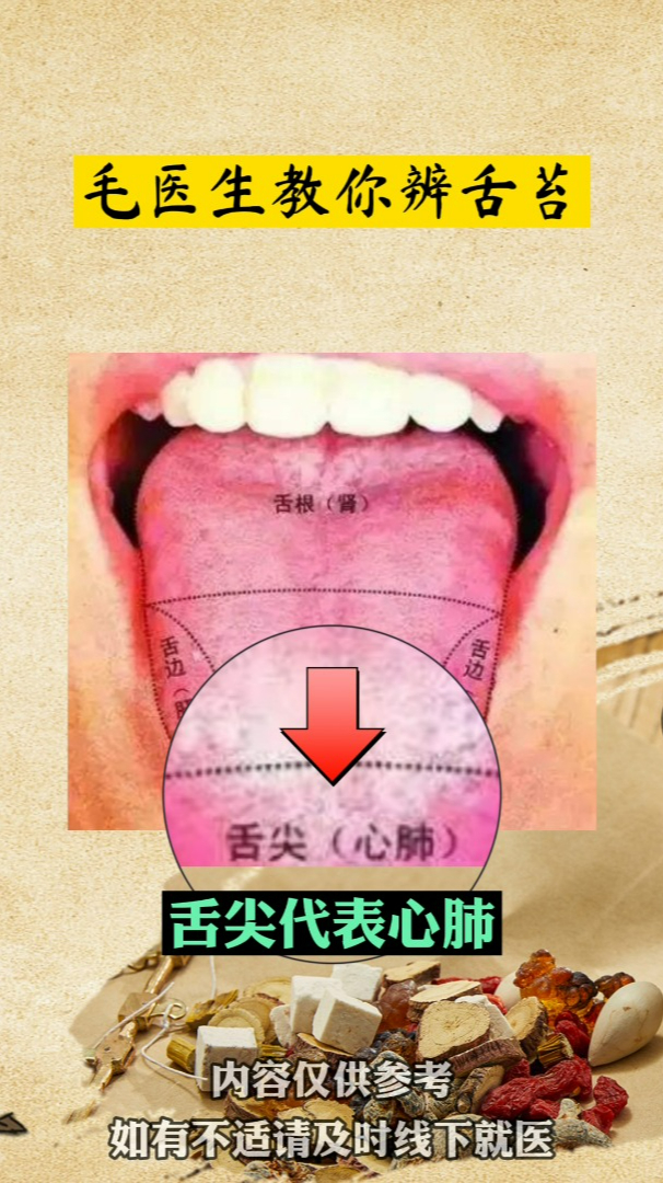 如何辨舌苔舌头不同部位指示不同脏腑