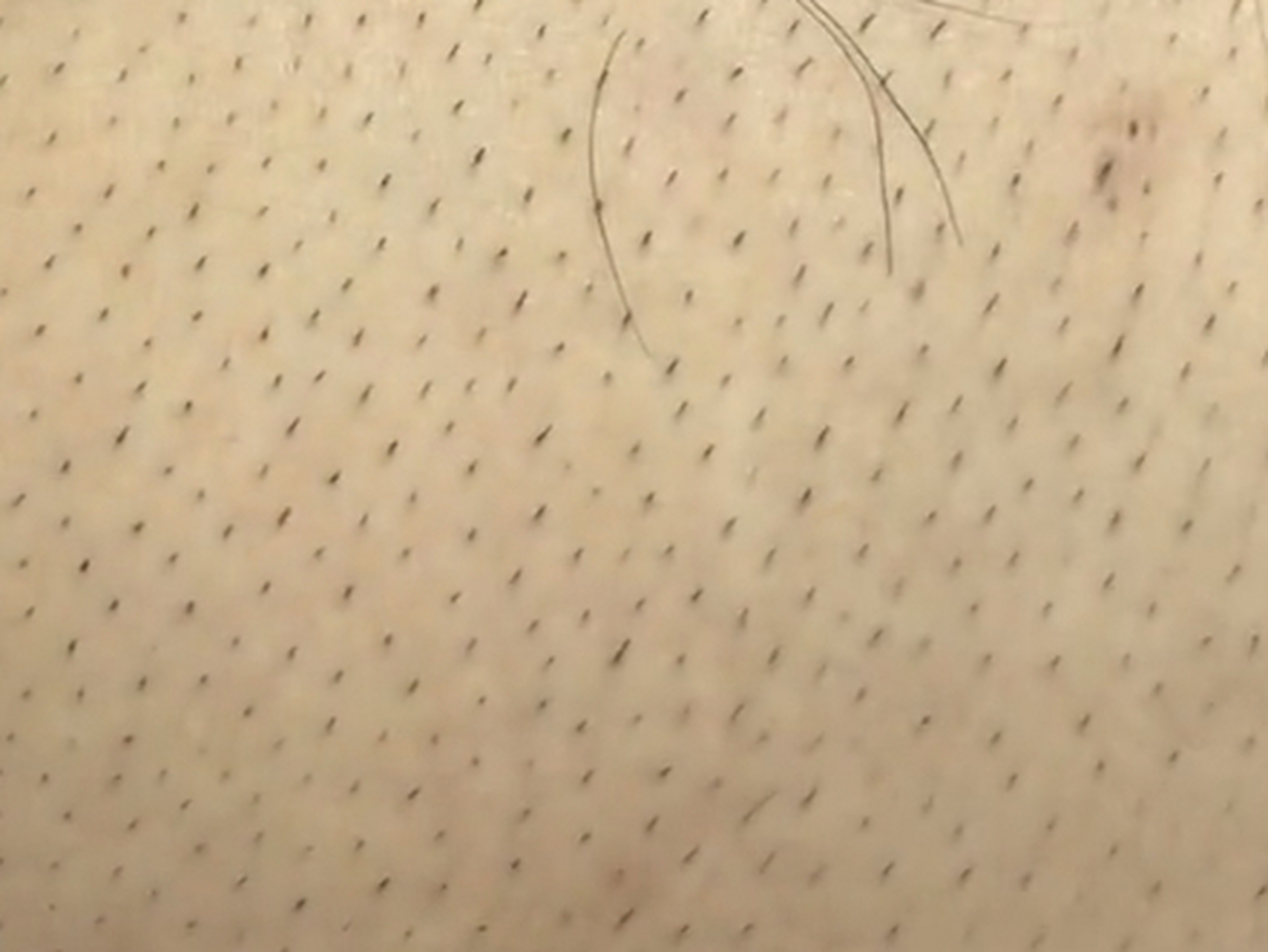 还有一些爱干净的女孩子,总觉得不干净,阴毛没毛用,还藏污纳垢,尤其