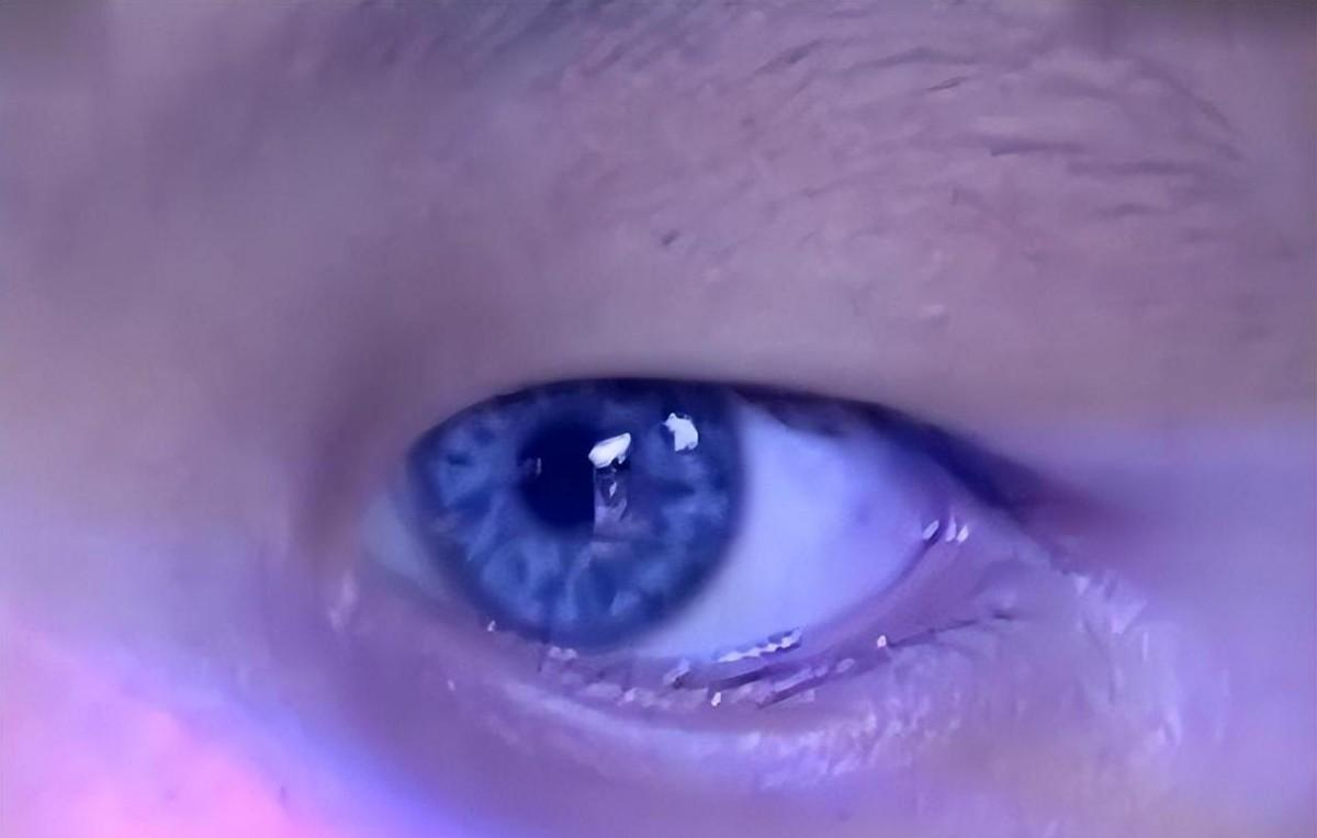 回顾一男童天生拥有蓝眼夜晚看东西如白天检查结果让全家沉默