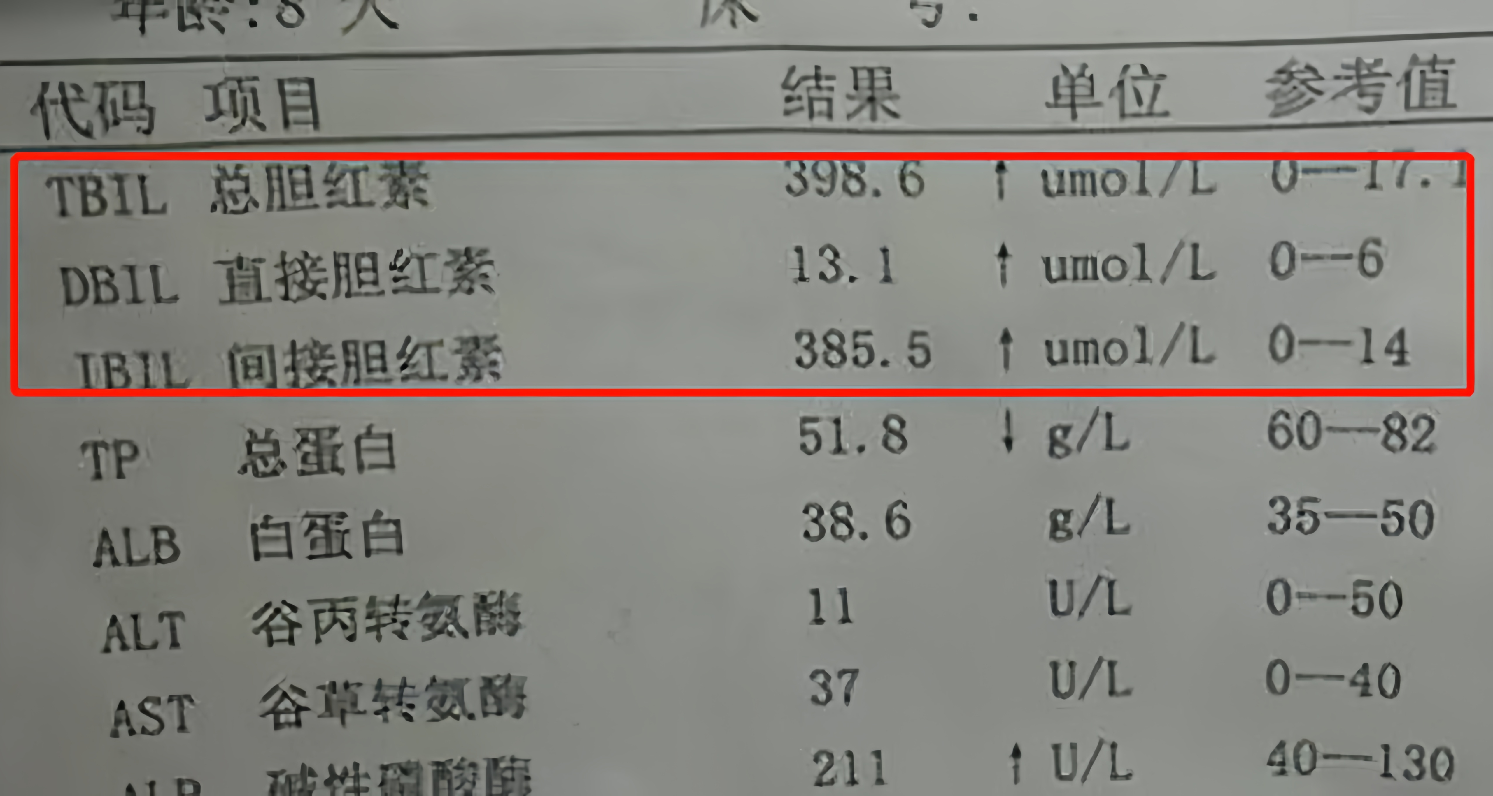 总胆红素偏高要紧吗图片