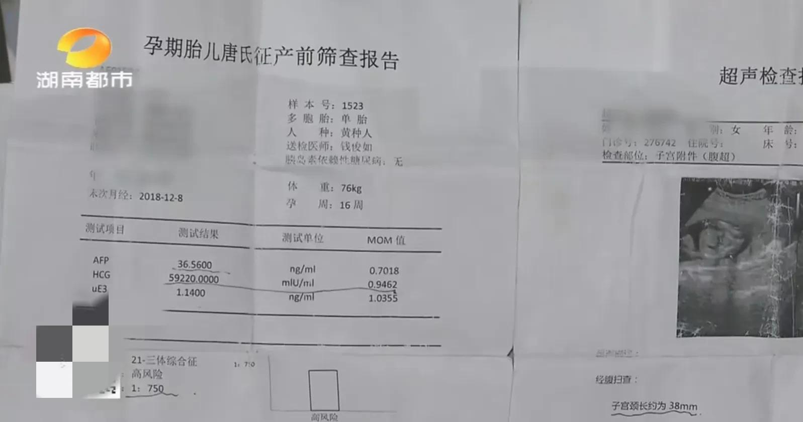 一看就会（假验孕报告）假怀孕验孕试纸能验出来吗 第6张