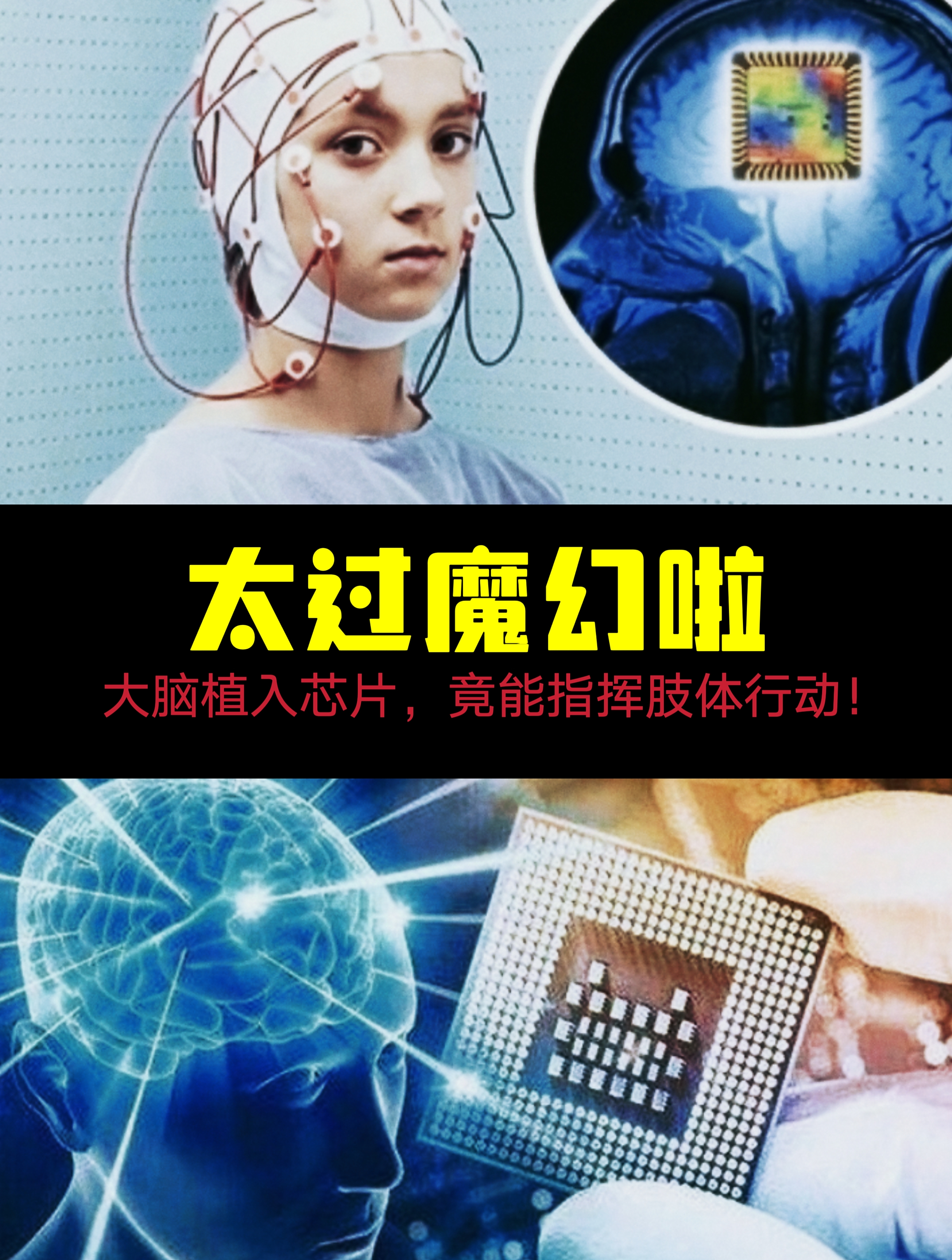 这不是科幻!芯片植入大脑,胸部以下重新有了感觉