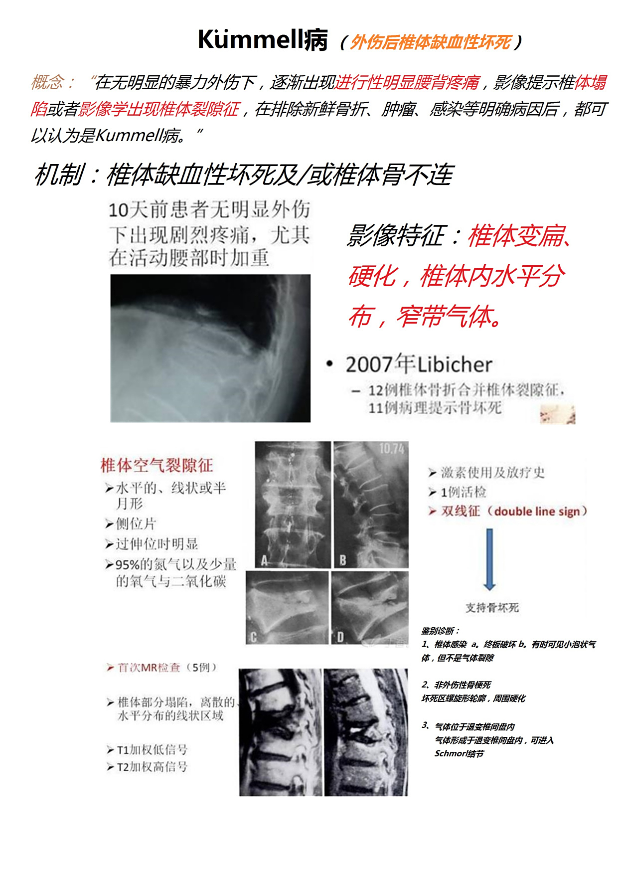 kummell病(外伤后椎体缺血性坏死)