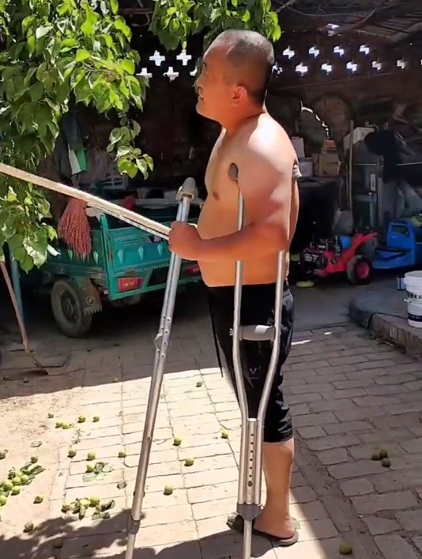 打黄油的李军家里的杏儿结的太多了把树也快压断了