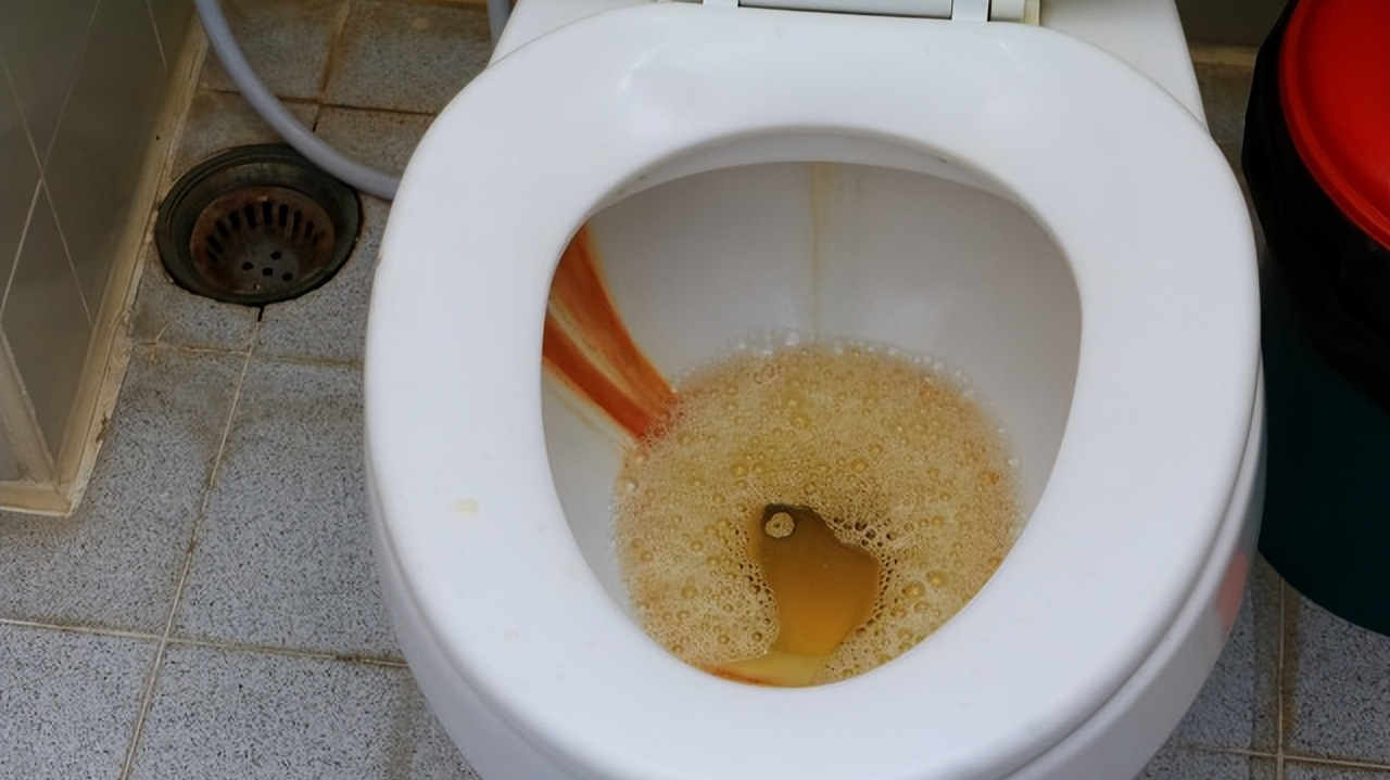 尿黄,泡沫多,是肾脏毒素超标吗?菜根泡水喝可以排毒?真相来了