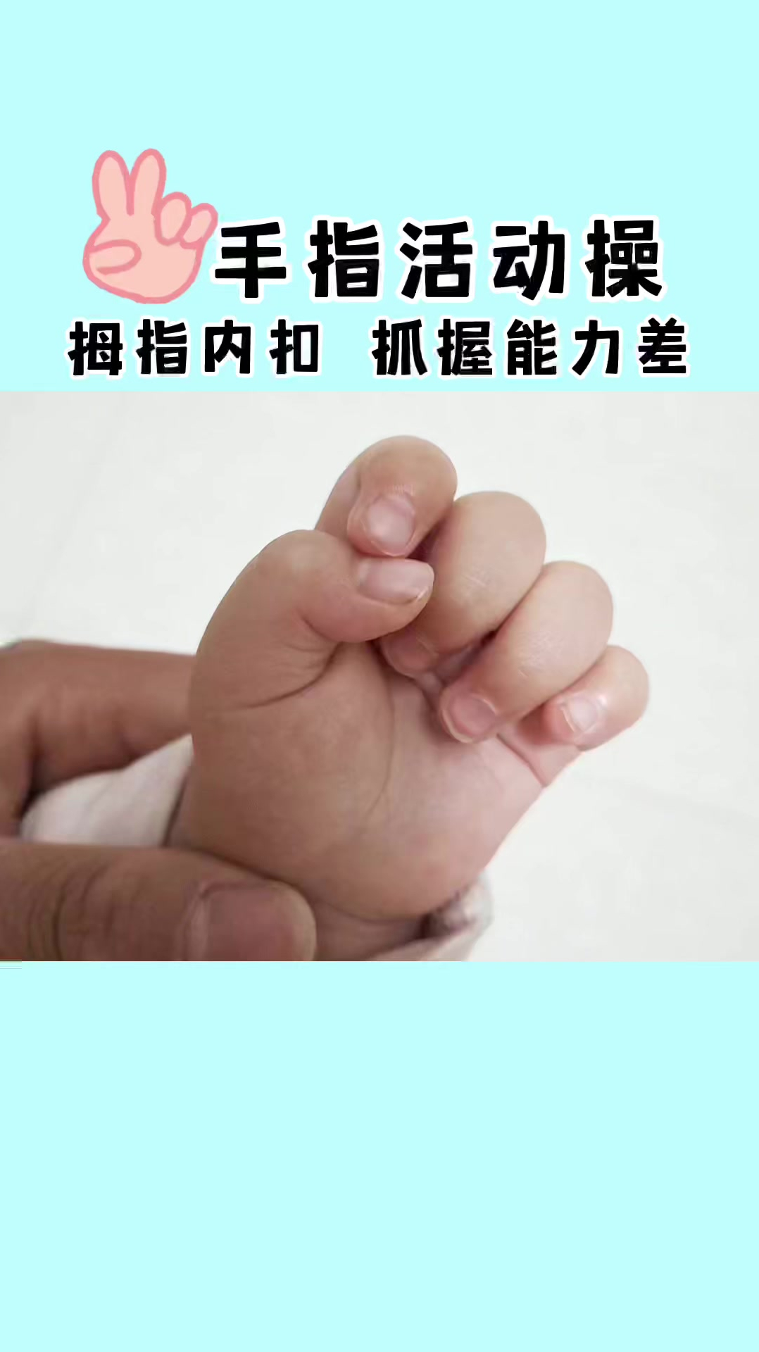 宝宝大拇指内扣,可能是宝宝肌张力过高的表现