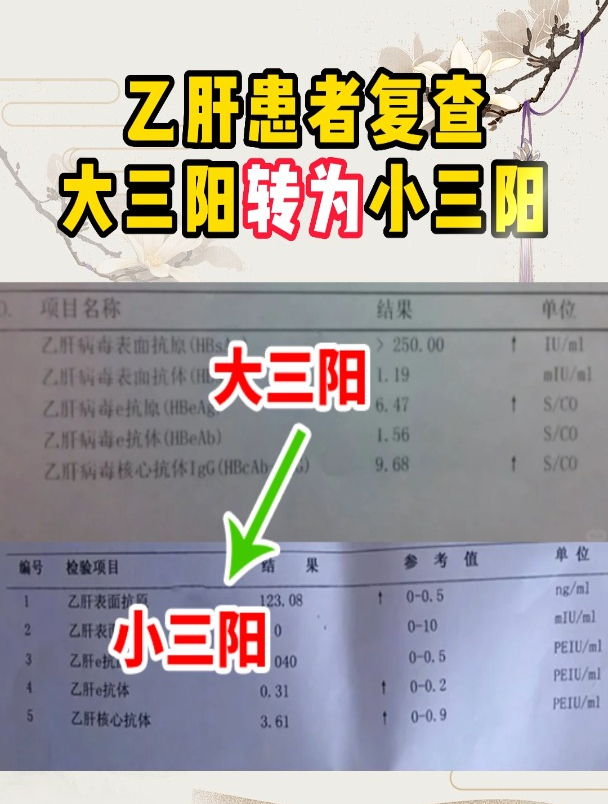 乙肝患者複查,大三陽轉換為小三陽,是好事嗎?