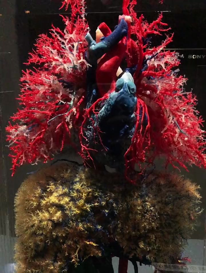 人体血管标本,像珊瑚一样