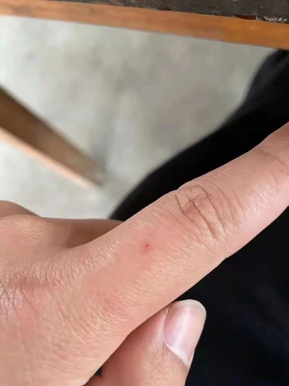 买家: 双十一买的冲锋衣暗藏一根针,扎伤手指 11月28日,白羽打算穿上