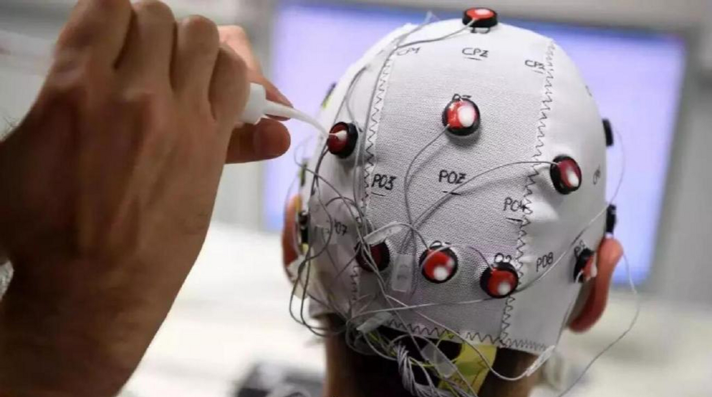 瘫痪男子大脑植入芯片触觉恢复