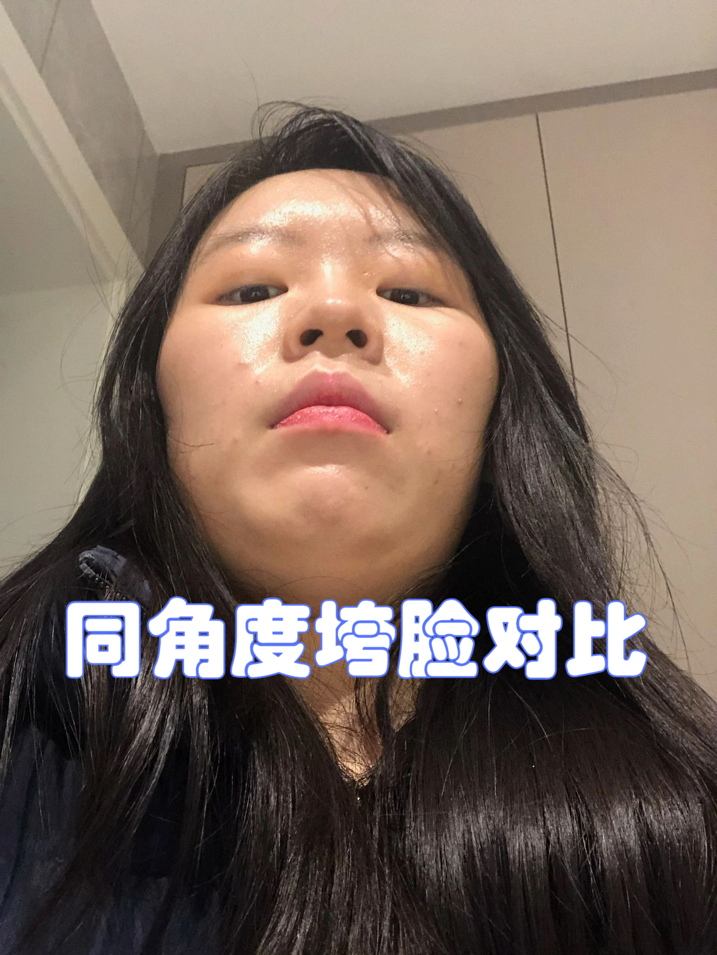 脸垮表现为:颧骨越来越宽,下颌越来越方 形成垮练背脸部的变化推