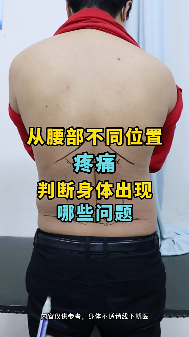从腰部不同位置疼痛判断身体出现哪些问题
