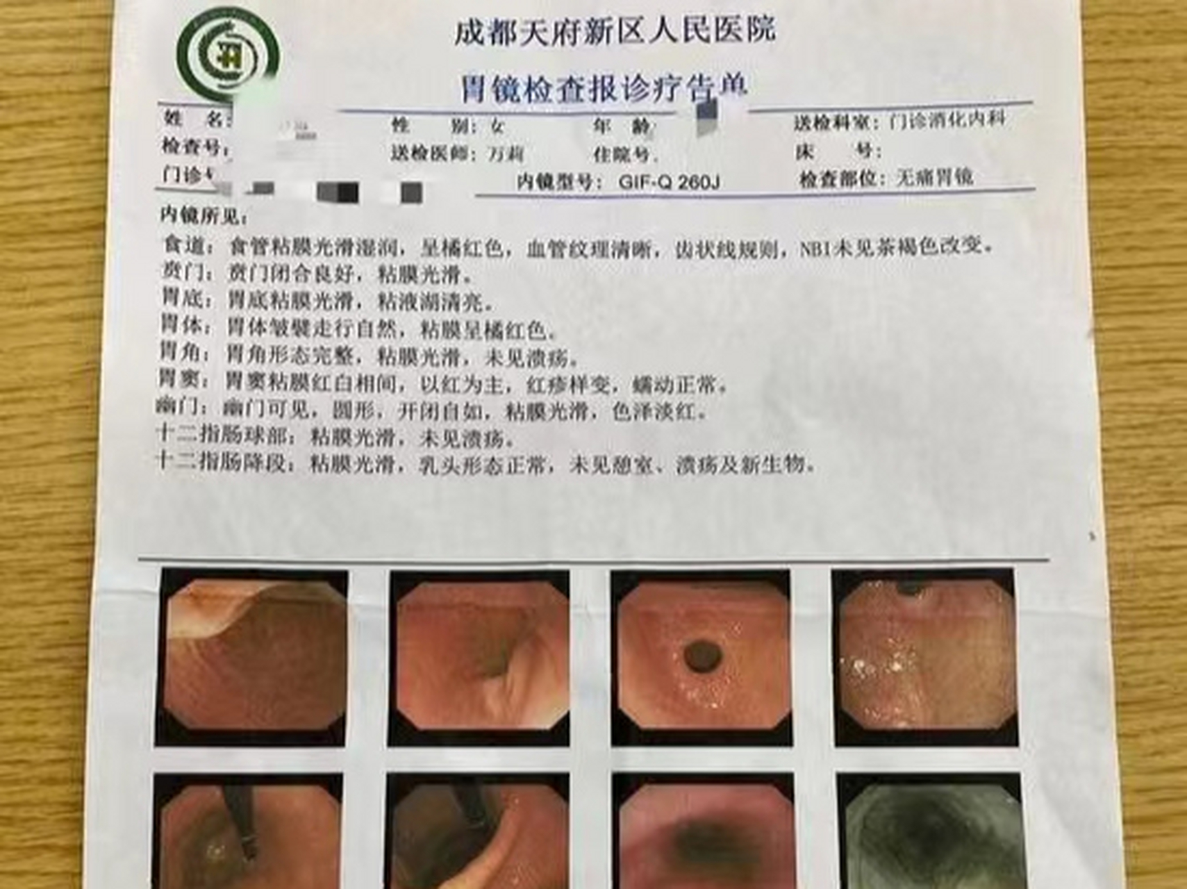 成都的刘女士胃窦炎多年,经常上腹部饱胀疼痛不适,吃西药后仍反复发作