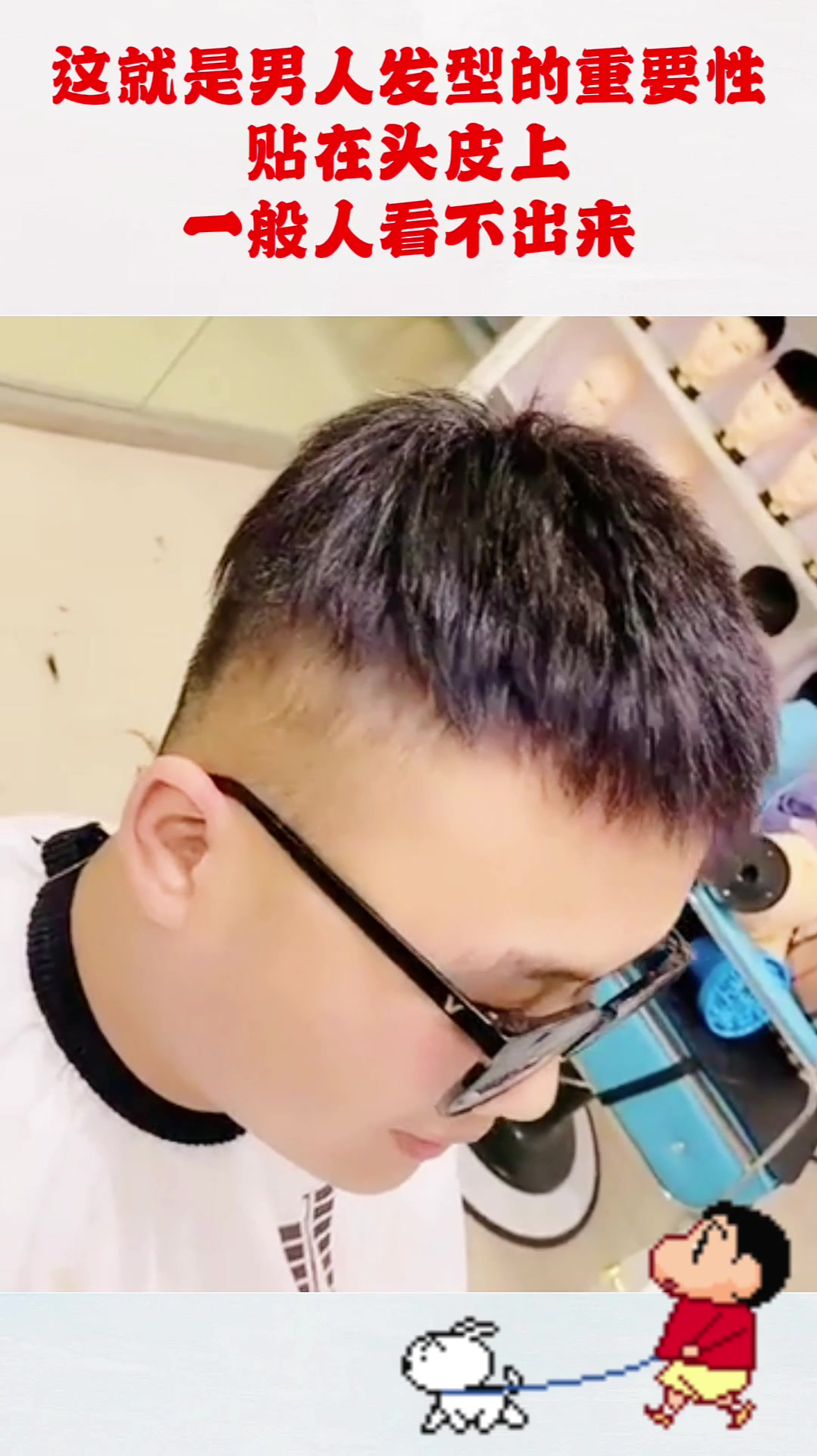 这就是男人发型的重要性,贴在头皮上,一般人看不出来!