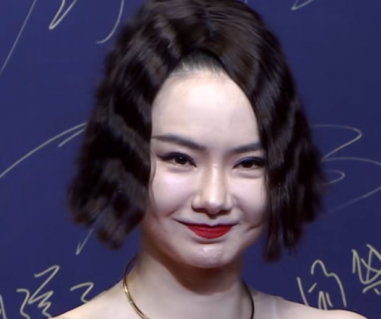 王鸥就曾因为打了瘦脸针,导致面瘫了,一边脸能笑一边脸不能动,所以笑