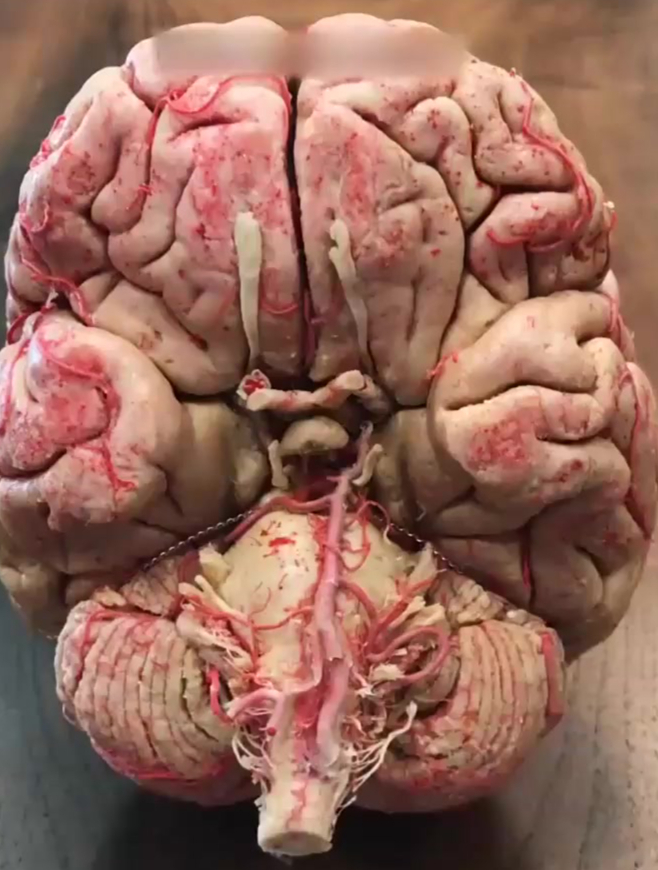 你知道我们的大脑长什么样子吗,今天带你深入了解一下