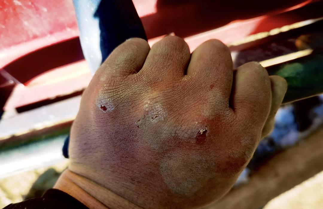 隔着屏幕的心疼零下10度辅警雪地救助手背伤痕累累