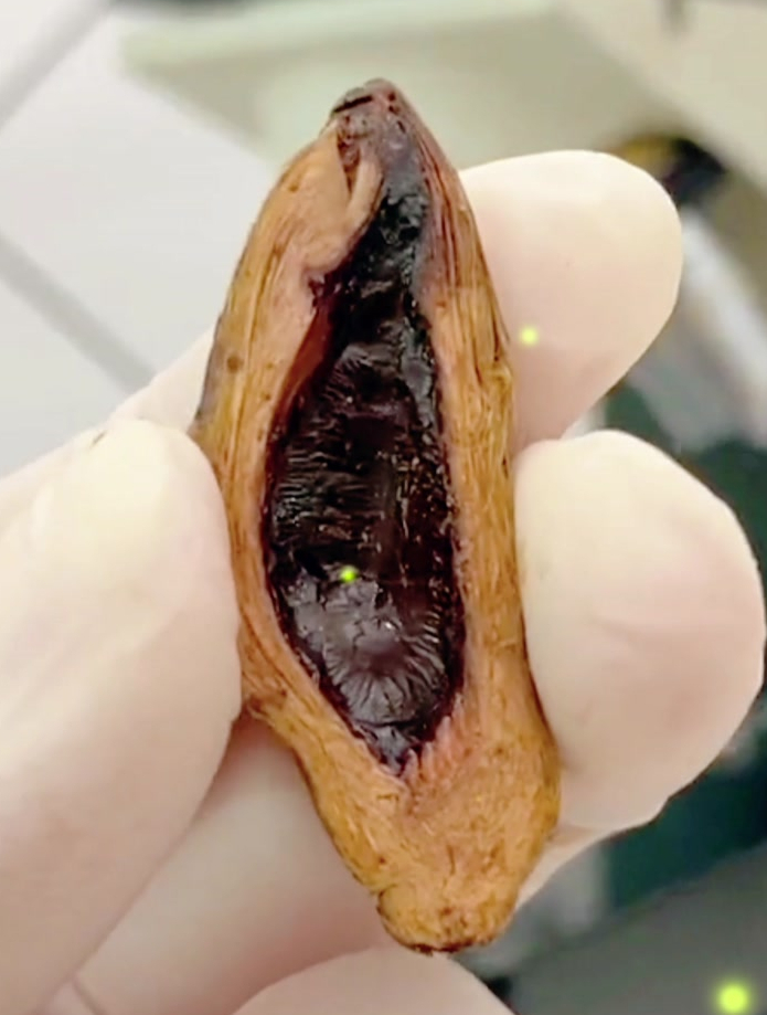 被列为一级致癌物放大后的槟榔你绝对没见过,看完你还敢吃吗?