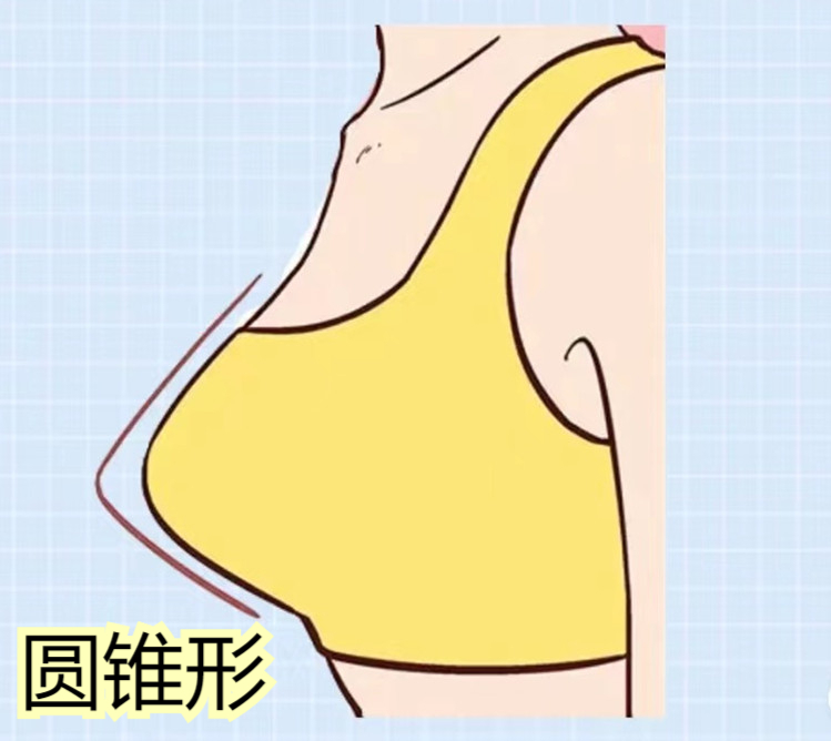 乳房呈圆锥形图片