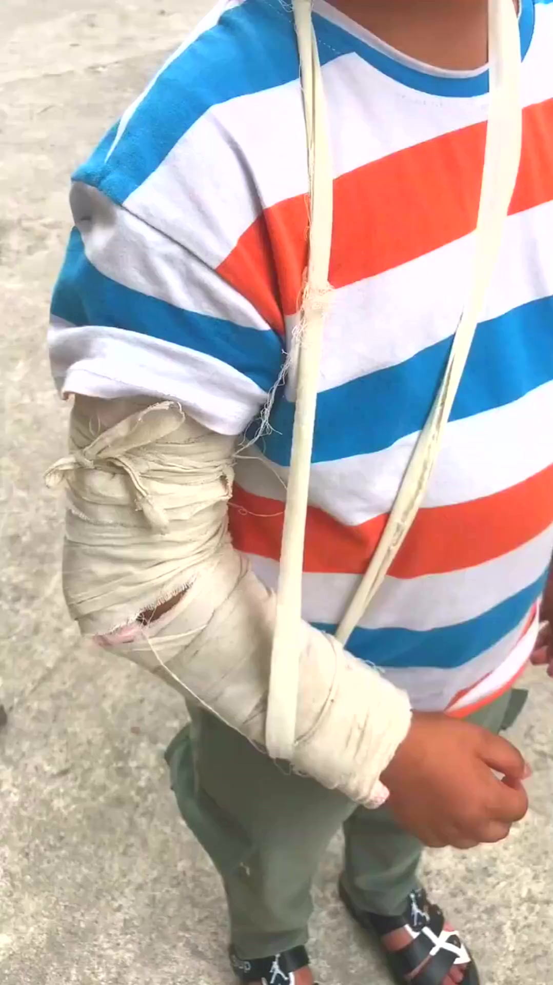 孩子为什么不能给老人带?孩子骨折打石膏,奶奶拆了在包上?