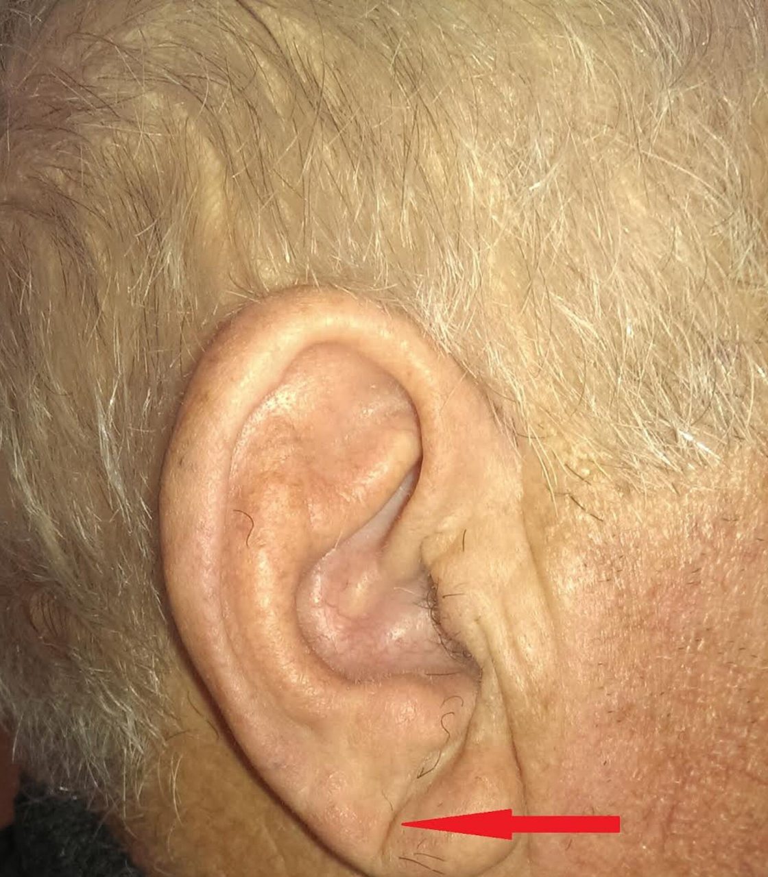 心悸,气短,心律不齐等症状,那可能已经发生了实际的病变,如冠心病