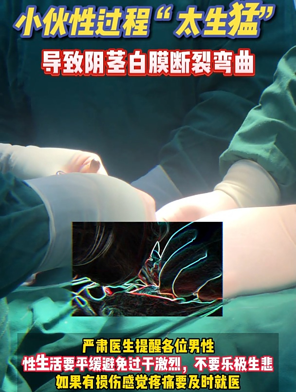 北京协和医院男科专家严肃教授:性过程太生猛导致阴茎白膜断裂