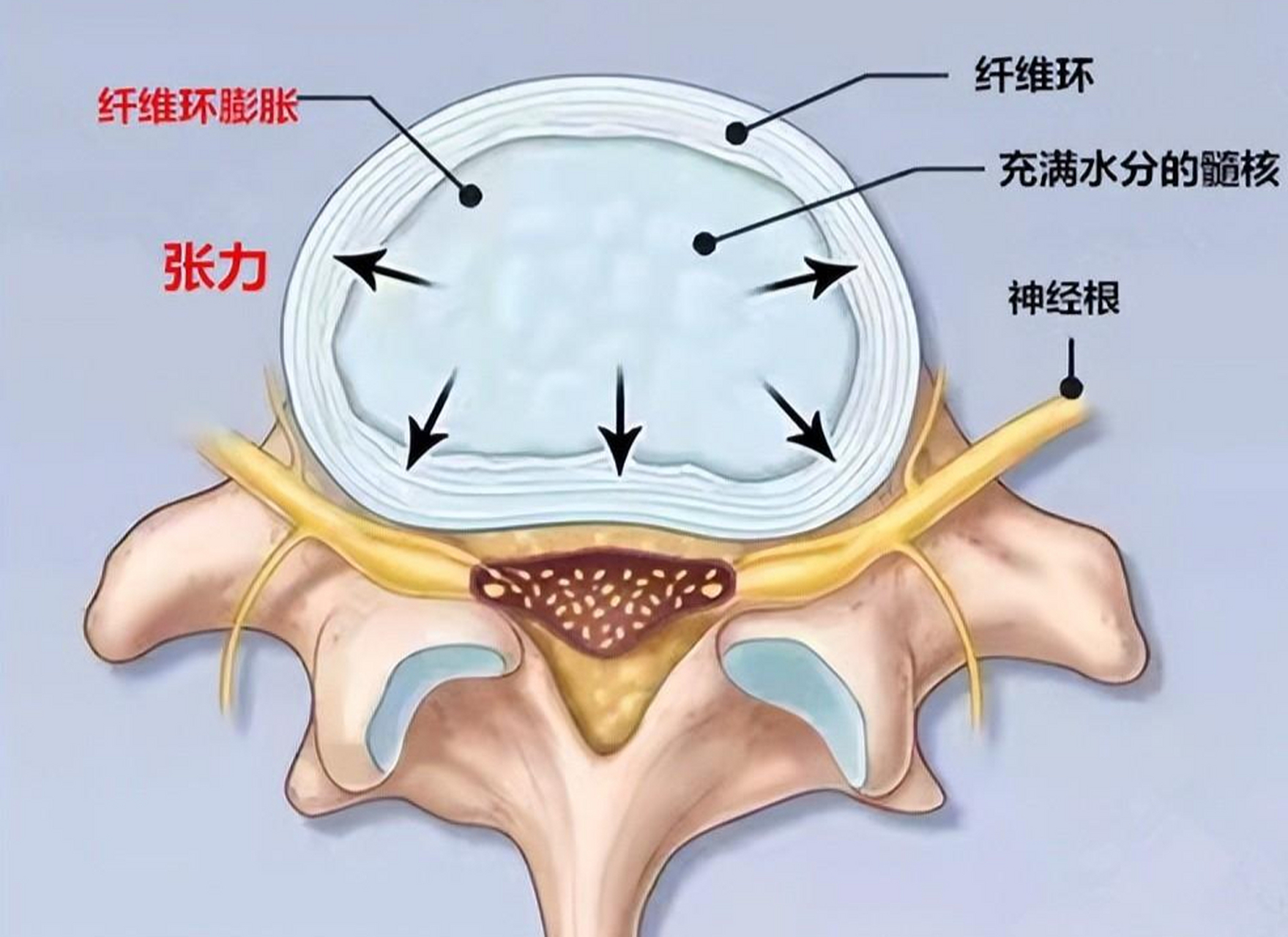 硬脊膜受压比间盘突出常见 在我们的日常生活中,大多数人都有颈椎不