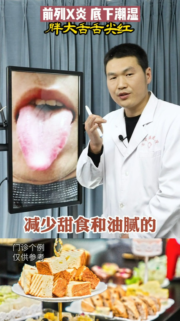 舌诊案例前列腺炎底下潮湿胖大舌舌尖红