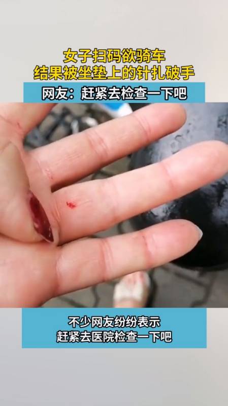 女子扫码欲骑车,结果被坐垫上的针扎破手-度小视