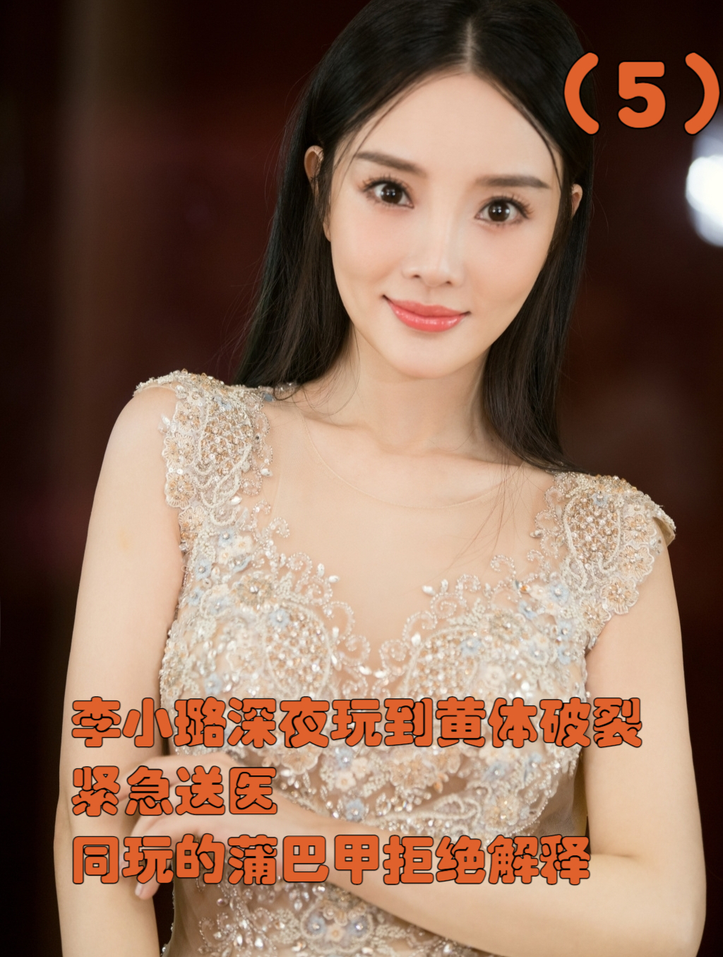 李小璐深夜玩到黄体破裂,紧急送医,同玩的蒲巴甲拒绝解释!