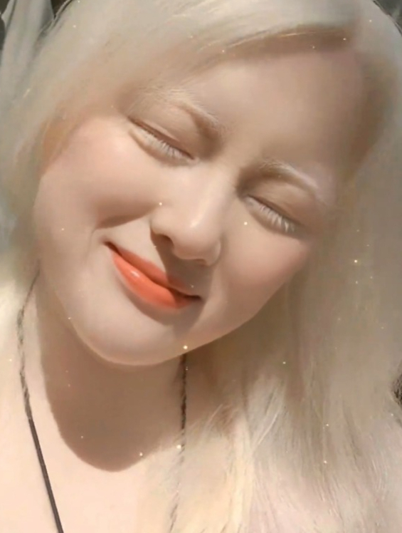 白化病女孩晒出美照,我觉得我笑起来很好看,但别人说我像裘千尺