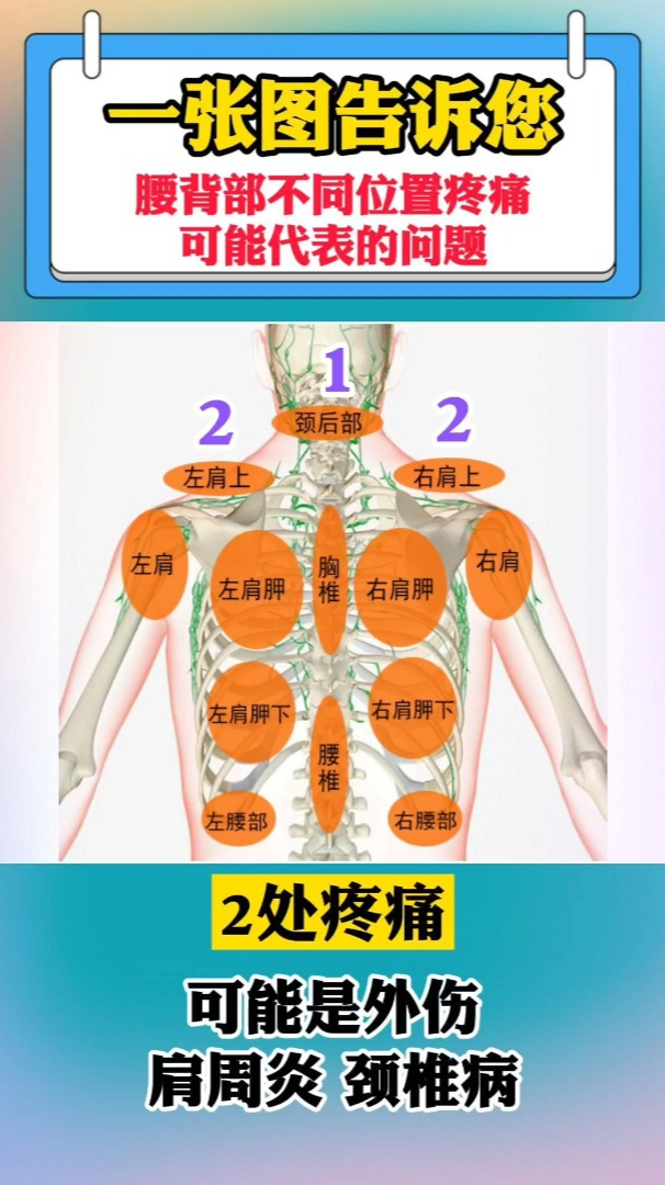 人体后面腰疼痛位置图图片