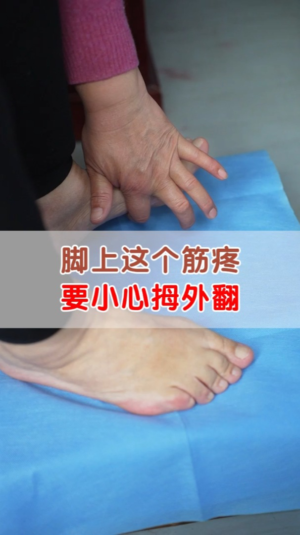 脚底板的这根筋疼是拇外翻惹的祸