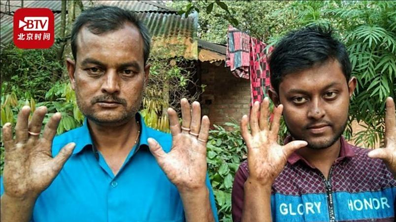 回顾人类指纹的斗和簸算真的是基因诅咒难道每个人未来早已注定