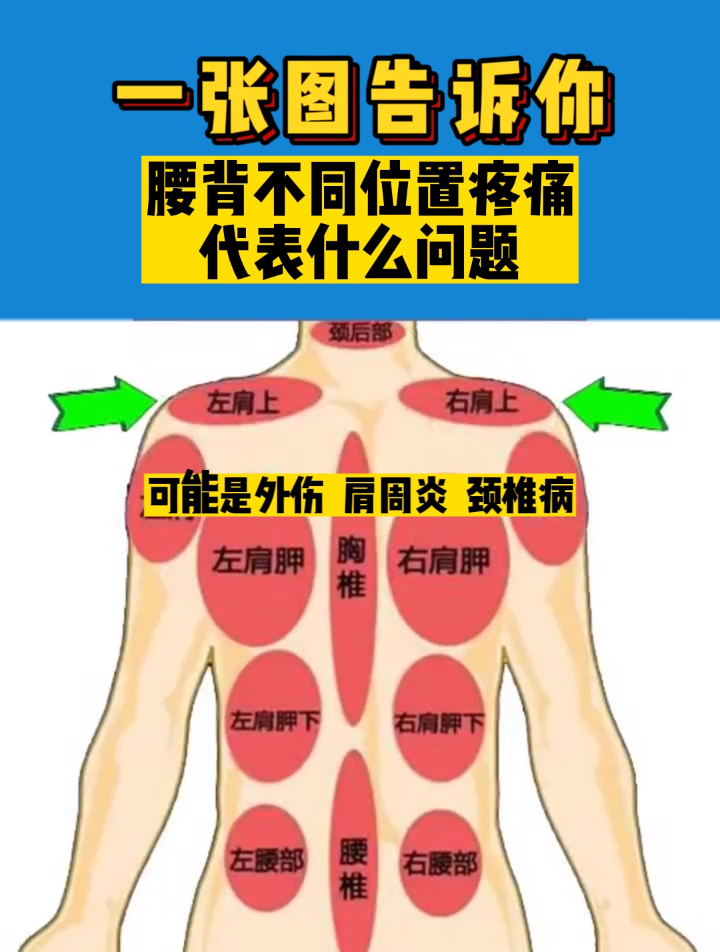 后背部位疼痛图解图片