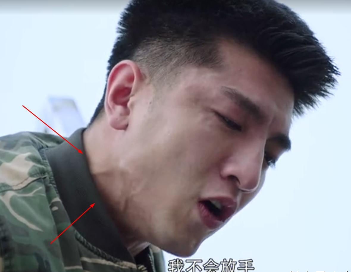 人体的颈静脉是右心房的压力计,一旦脖子青筋暴起,就表明静脉压增高