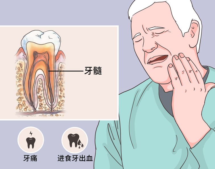 牙髓图片