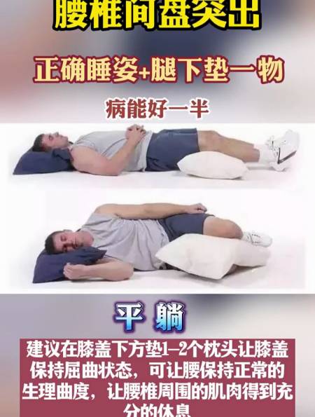 腰椎间盘突出正确睡姿腿下垫一物就能好一半
