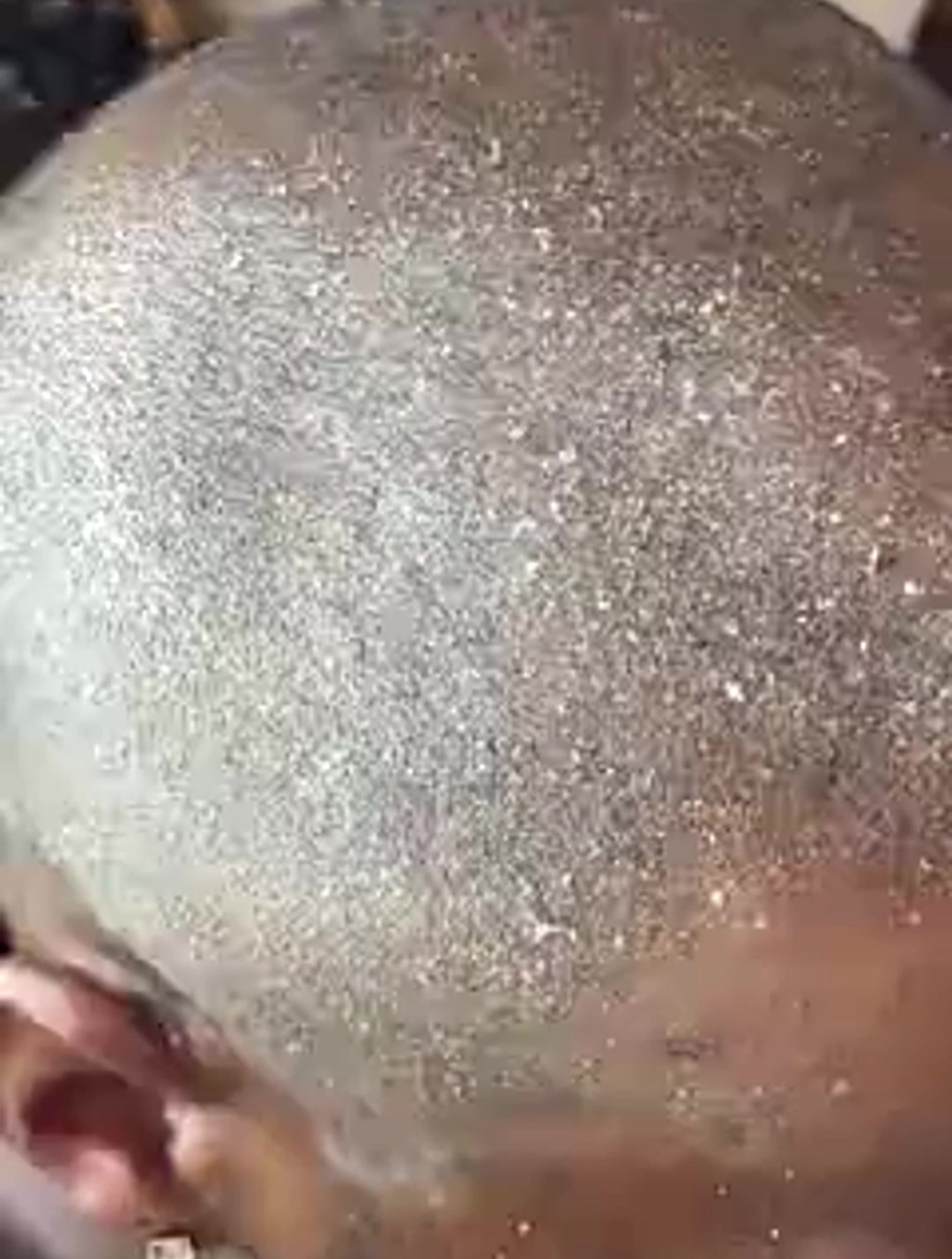 摩擦摩擦是魔鬼的手法,光头头皮屑清理,恶心